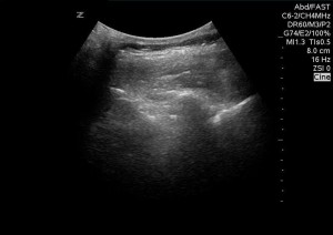 Ultrasound image in sagittal plane