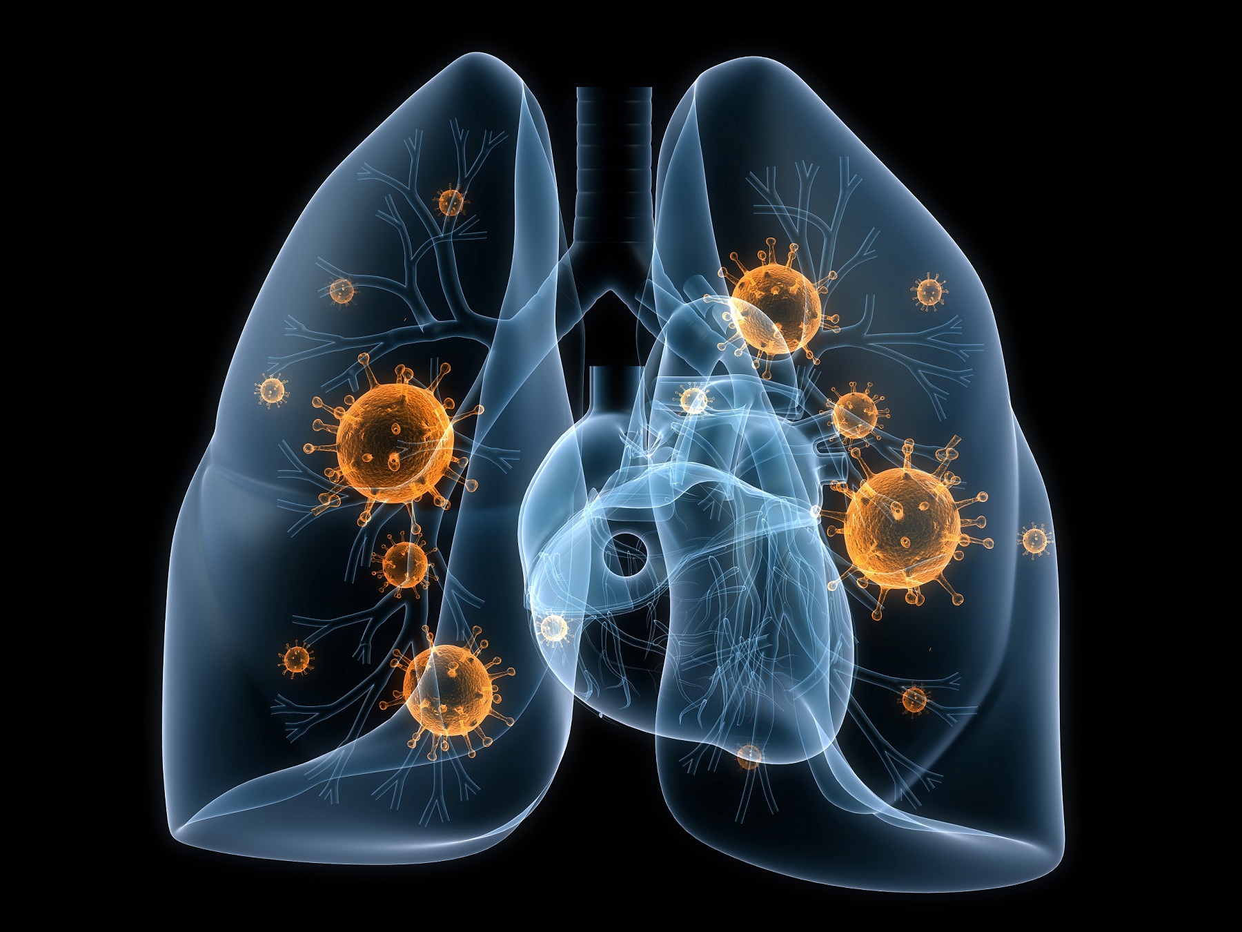 lungs-with-bacteria-low-res-the-em-pulse