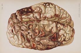 injured anatomic brain